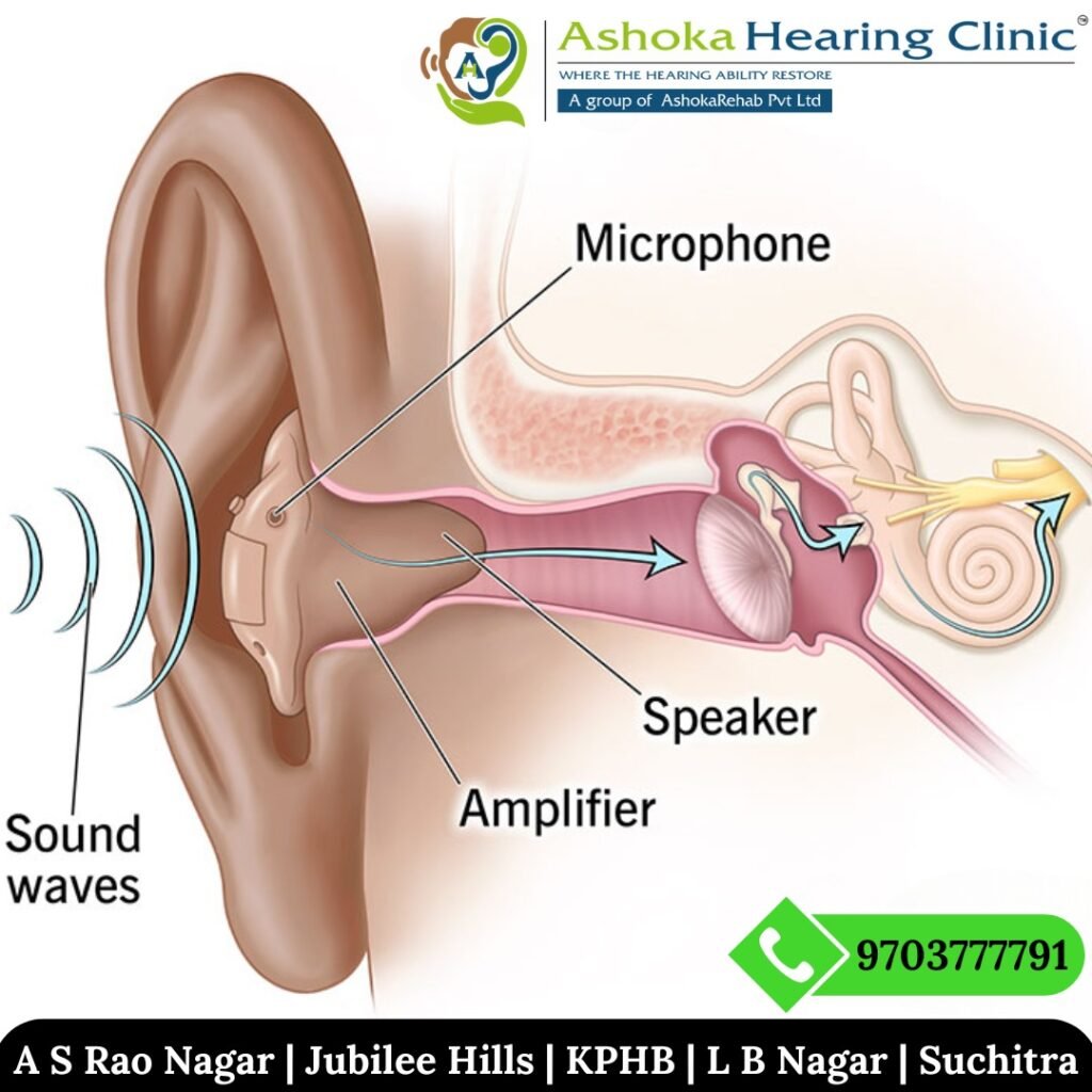 ashoka hearing clinic's picture representation on how hearing aids work